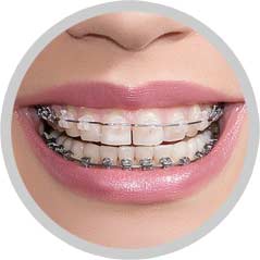 South Calgary Orthodontist | McKenzie Orthodontics Braces