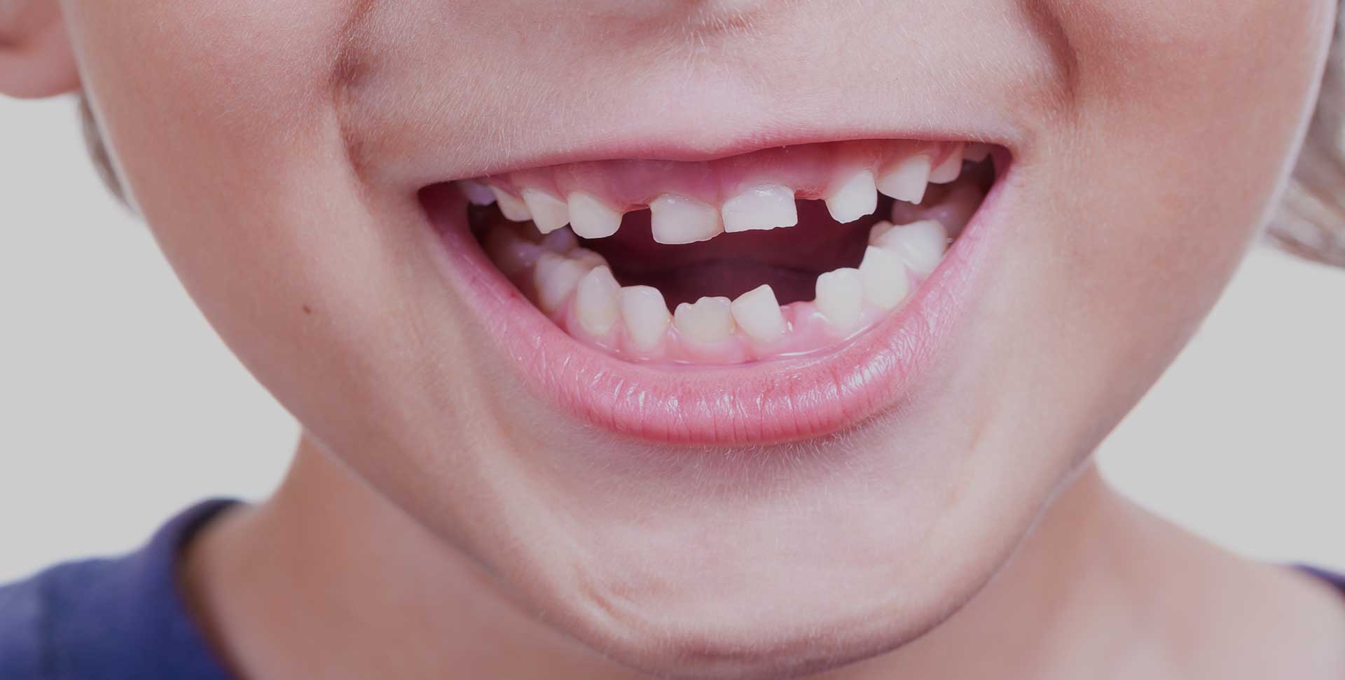 South Calgary Orthodontist | McKenzie Orthodontics | Early Orthodontic Treatment