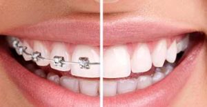 South Calgary Orthodontist | McKenzie Orthodontics | Braces