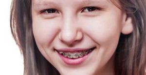 South Calgary Orthodontist | McKenzie Orthodontics | Emergency Orthodontics