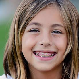 South Calgary Orthodontist | McKenzie Orthodontics | Dentofacial Orthopedics